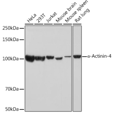 Alpha-Actinin-4 Rabbit Monoclonal Antibody