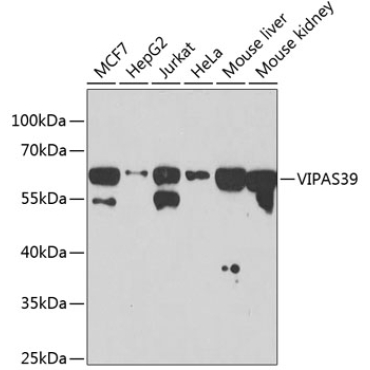 VIPAS39 Rabbit Polyclonal Antibody