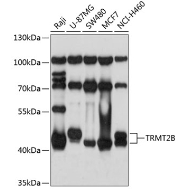 TRMT2B Rabbit Polyclonal Antibody