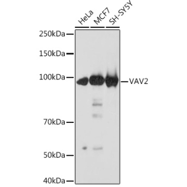VAV2 Rabbit Monoclonal Antibody