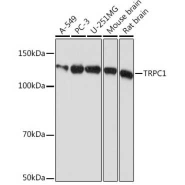TRPC1 Rabbit Monoclonal Antibody