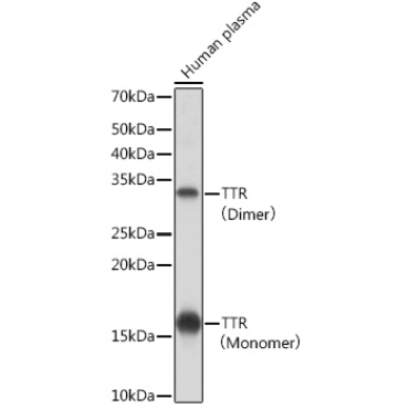 TTR Rabbit Monoclonal Antibody