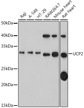 UCP2 Rabbit Polyclonal Antibody