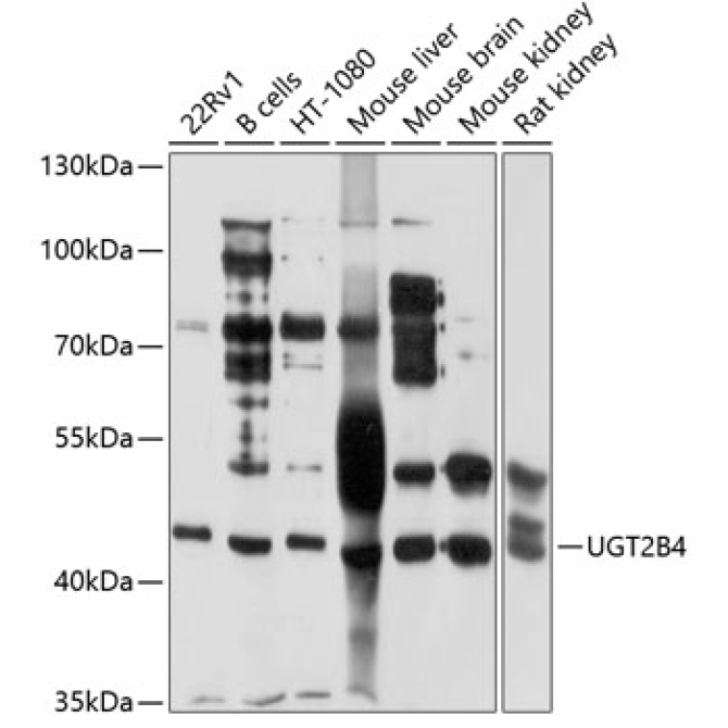 UGT2B4 Rabbit Polyclonal Antibody
