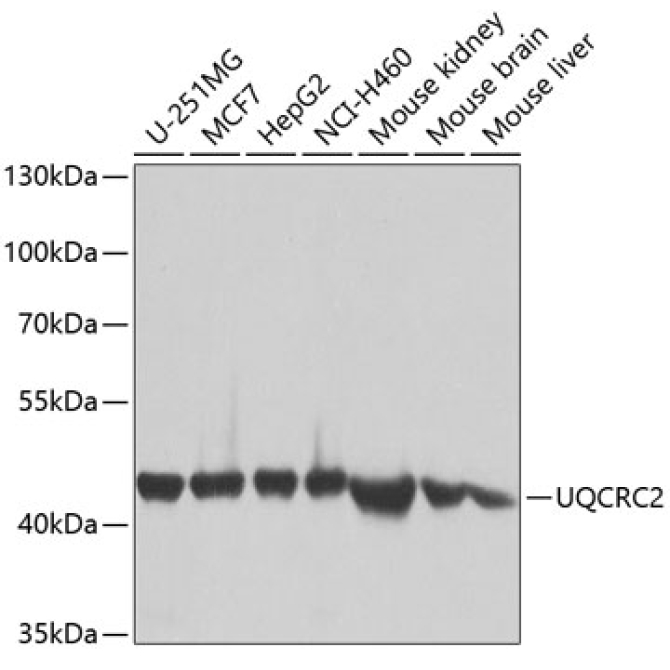 UQCRC2 Rabbit Polyclonal Antibody