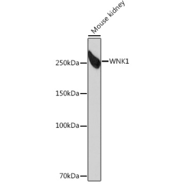WNK1 Rabbit Monoclonal Antibody
