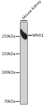 WNK1 Rabbit Monoclonal Antibody