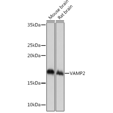 VAMP2 Rabbit Monoclonal Antibody