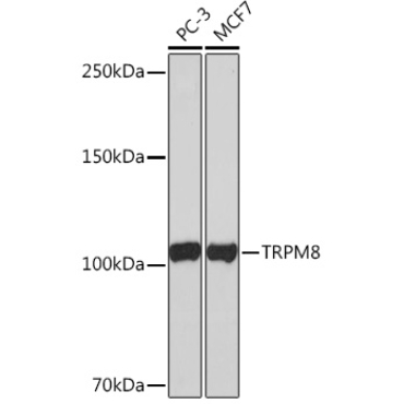 TRPM8 Rabbit Monoclonal Antibody