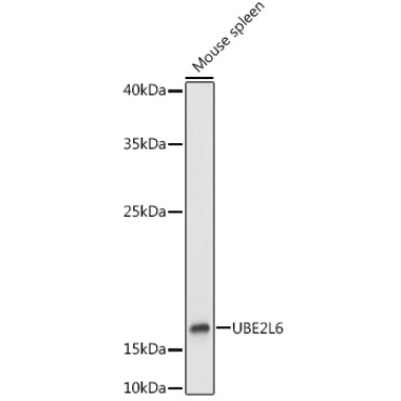 UBE2L6 Rabbit Polyclonal Antibody