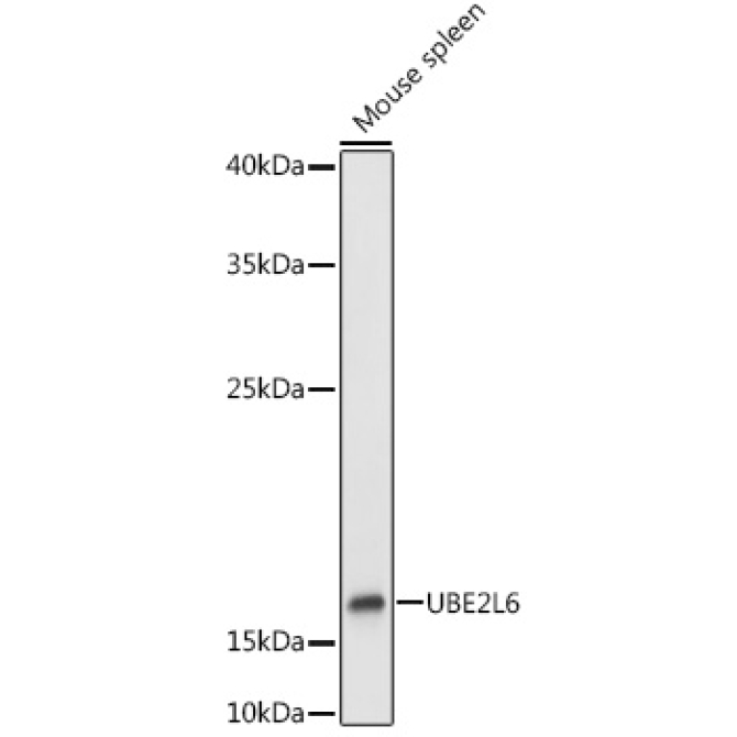 UBE2L6 Rabbit Polyclonal Antibody