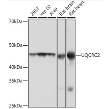 UQCRC2 Rabbit Monoclonal Antibody