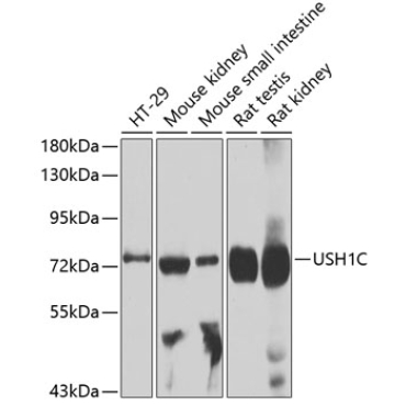 USH1C Rabbit Polyclonal Antibody
