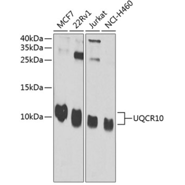 UQCR10 Rabbit Polyclonal Antibody