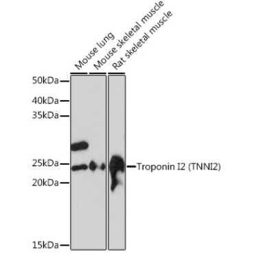 Troponin I2 (TNNI2) Rabbit Monoclonal Antibody