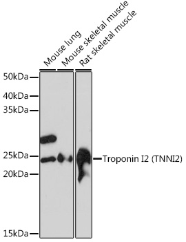 Troponin I2 (TNNI2) Rabbit Monoclonal Antibody