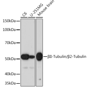 BetaII-Tubulin/Beta2-Tubulin Rabbit Monoclonal Antibody
