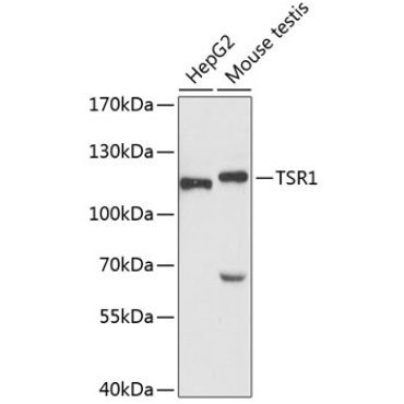 TSR1 Rabbit Polyclonal Antibody