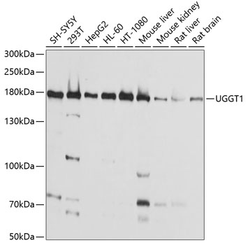 UGGT1 Rabbit Polyclonal Antibody