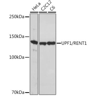UPF1/RENT1 Rabbit Monoclonal Antibody