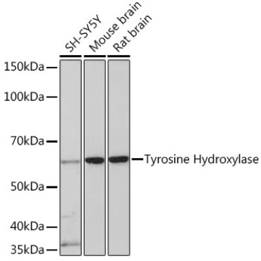 Tyrosine Hydroxylase Rabbit Monoclonal Antibody