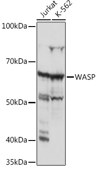 WASP Rabbit Monoclonal Antibody