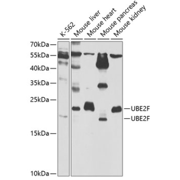 UBE2F Rabbit Polyclonal Antibody