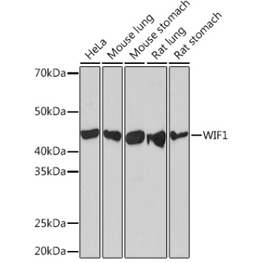 WIF1 Rabbit Monoclonal Antibody
