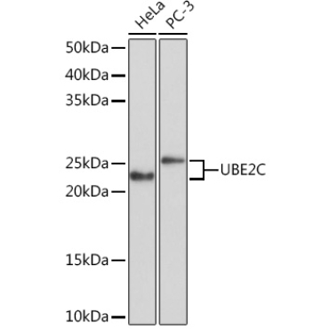 UBE2C Rabbit Monoclonal Antibody