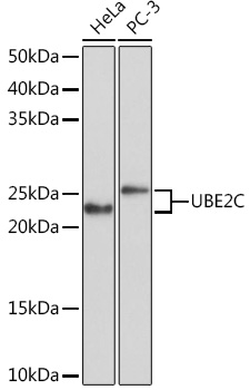 UBE2C Rabbit Monoclonal Antibody
