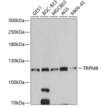TRPM8 Rabbit Polyclonal Antibody