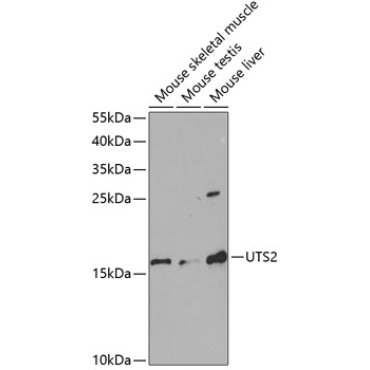 UTS2 Rabbit Polyclonal Antibody