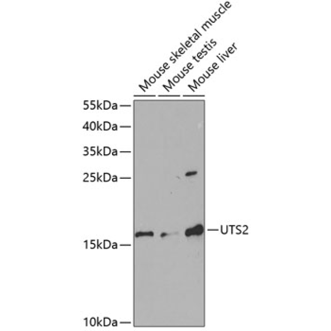 UTS2 Rabbit Polyclonal Antibody