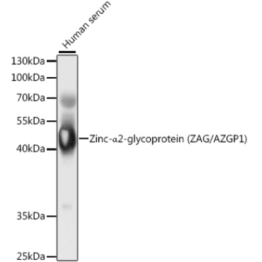 Zinc-Alpha2-glycoprotein (ZAG/AZGP1) Rabbit Polyclonal Antibody