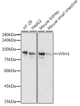 Villin1 Rabbit Polyclonal Antibody