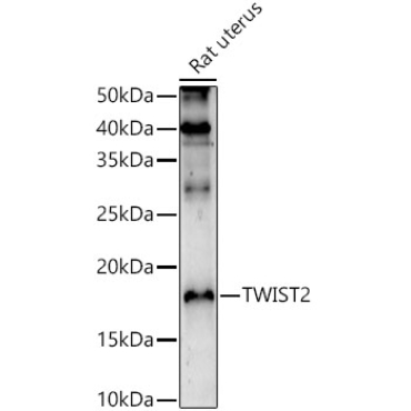 TWIST2 Rabbit Polyclonal Antibody