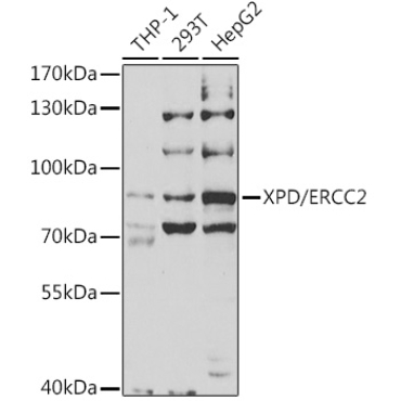 XPD/ERCC2 Rabbit Polyclonal Antibody