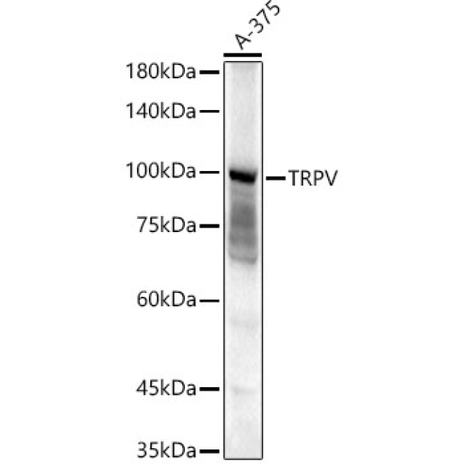 TRPV4 Rabbit Polyclonal Antibody