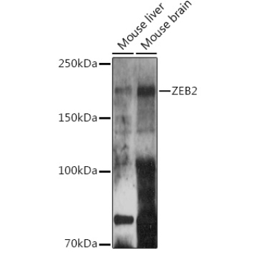 ZEB2 Rabbit Polyclonal Antibody