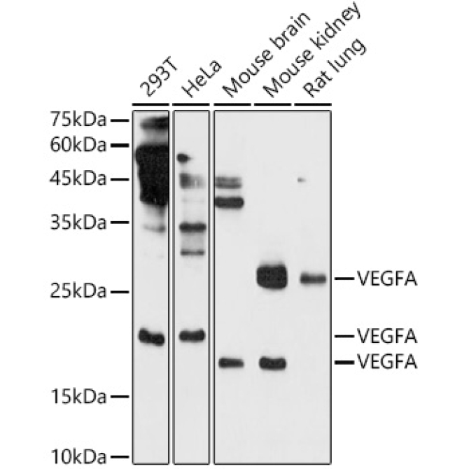 VEGFA Rabbit Polyclonal Antibody