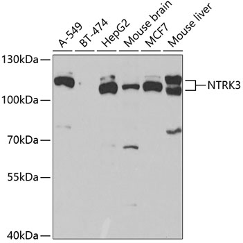 TrKC Rabbit Polyclonal Antibody