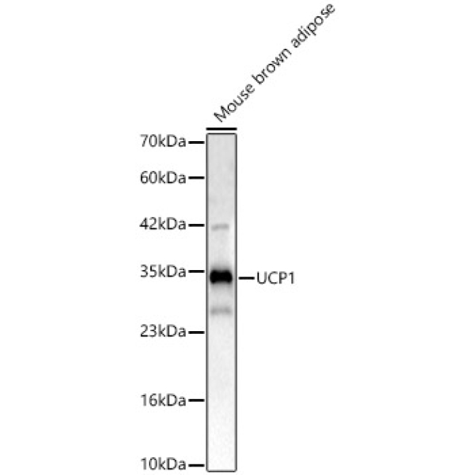 UCP1 Rabbit Polyclonal Antibody