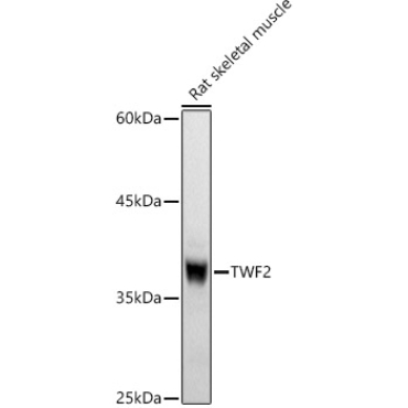 TWF2 Rabbit Polyclonal Antibody
