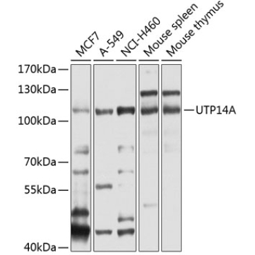 UTP14A Rabbit Polyclonal Antibody
