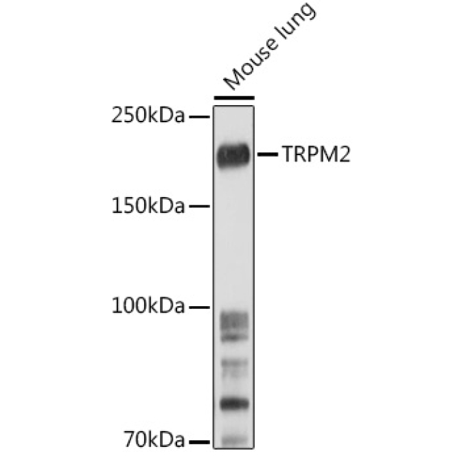 TRPM2 Rabbit Polyclonal Antibody