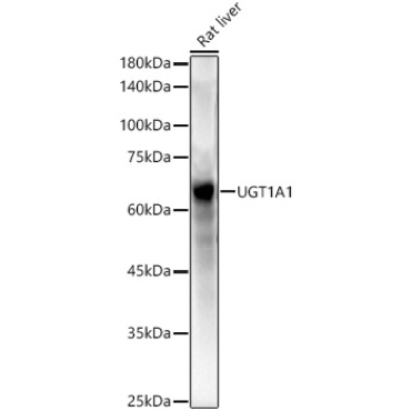UGT1A1 Rabbit Polyclonal Antibody