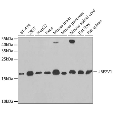 UBE2V1 Rabbit Polyclonal Antibody
