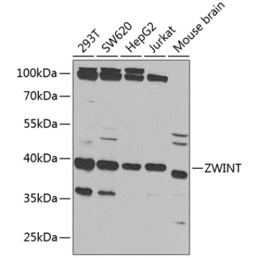 ZWINT Rabbit Polyclonal Antibody