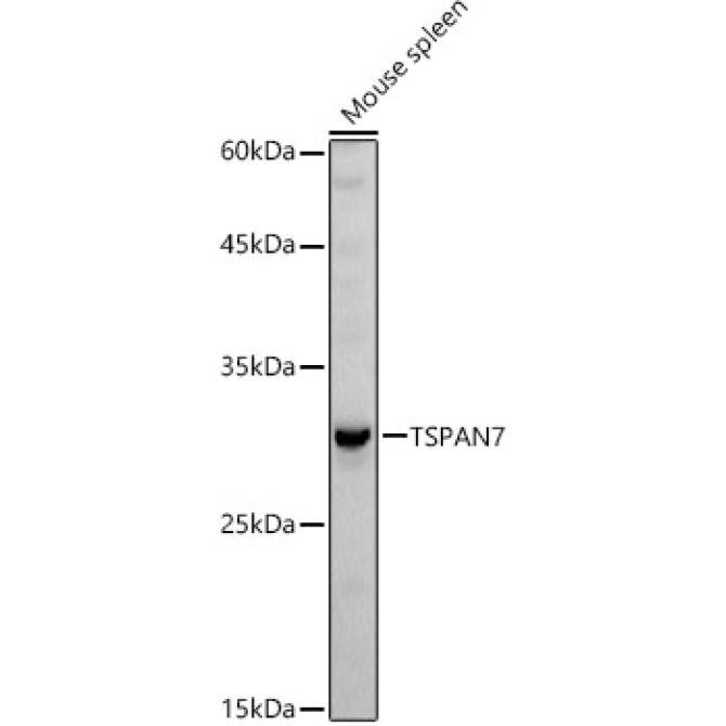 TSPAN7 Rabbit Polyclonal Antibody