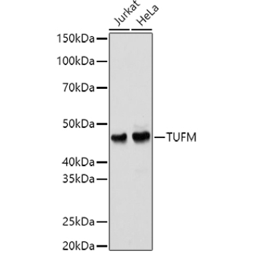 TUFM Rabbit Polyclonal Antibody